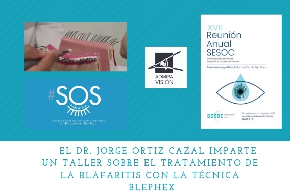 En la XVII Reunión de la SESOC (Sociedad Española de Superficie Ocular y Córnea), el Dr. Jorge Ortiz Cazal, experto en superfície ocular de nuestro grupo, impartió un taller sobre el tratamiento de la blefaritis, una de las principales causas asociadas al Síndrome del ojo seco. El eje princial del taller fue poner en conocimiento de los asistentes, la presencia de un ecosistema de microorganismos en los párpados, en forma de biopelícula, la cual es removida automáticamente mediante el sistema de blefaroexfoliación con Blephex. Este taller se impartió en el marco de la campaña de concienciación y pervención del síndrome del ojo seco #SOSPARPADEA. El taller tuvo una gran acogida entre los participantes. Este tratamiento está dando muy buenos resultados entre nuestros pacientes afectados de esta patología.